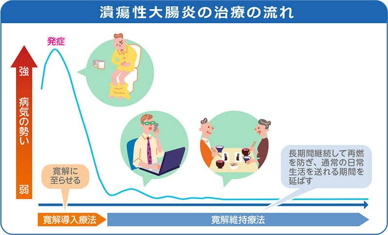 潰瘍性大腸炎の治療の流れ