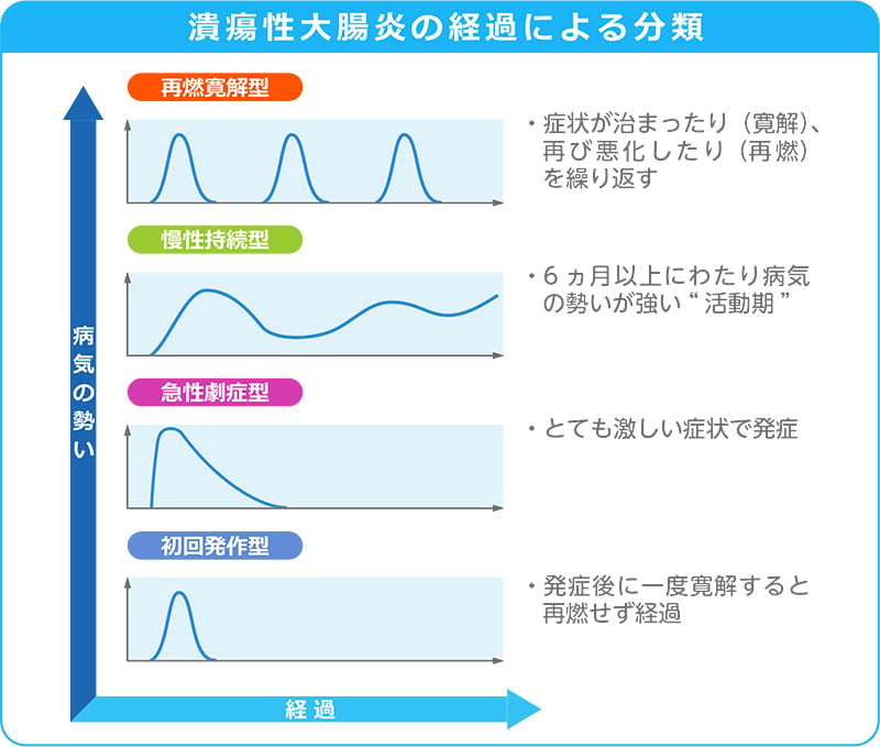 潰瘍性大腸炎の経過による分類